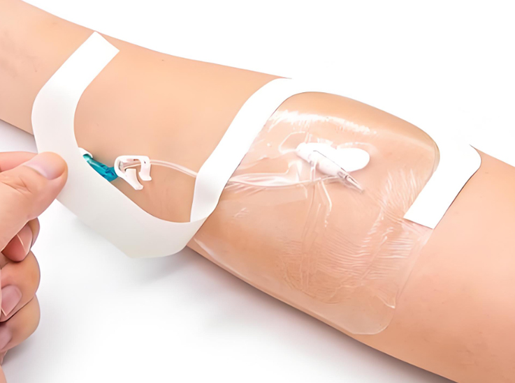 Clinical fixation of syringe cap film